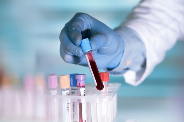 Testen virum Chirurgie