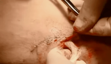 Aarte vun Operatiounen fir d 